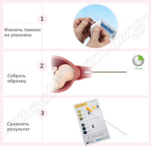Амниотест тестирование
